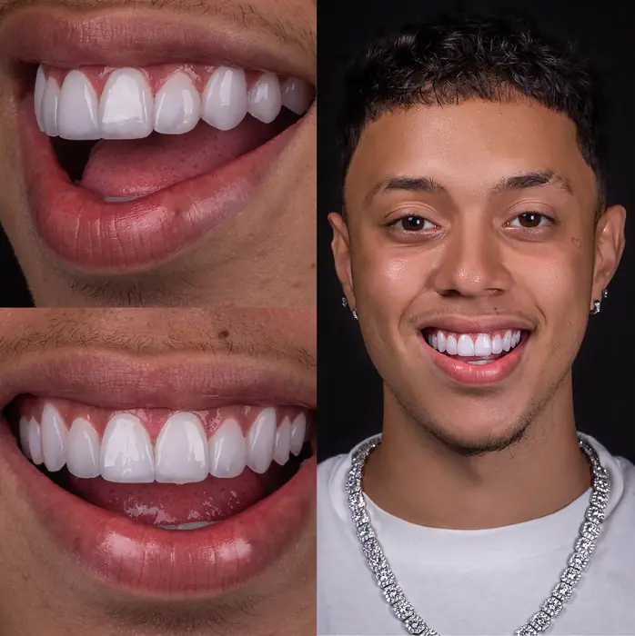 Resultado real 6 - sorriso transformado pela Clínica Viotto