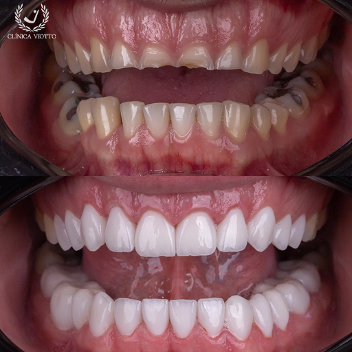 Estética do Sorriso Viotto Especializada