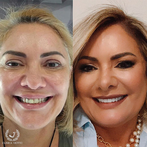 Harmonização Facial Viotto Referência