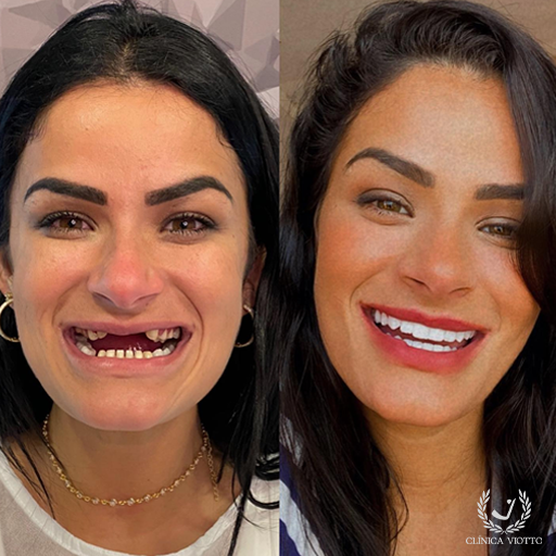 Implantes Dentários Viotto Clínica
